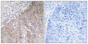 ApoL2 rabbit pAb Antibody