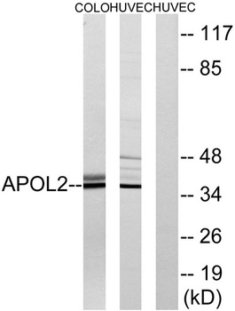ApoL2 rabbit pAb Antibody