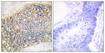 APRIL rabbit pAb Antibody