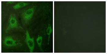 AQP2 rabbit pAb Antibody
