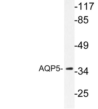 AQP5 rabbit pAb Antibody