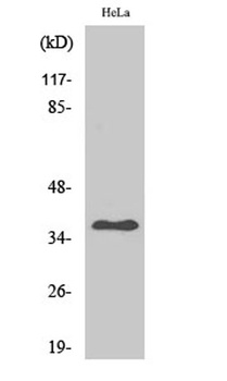 Arginase II rabbit pAb Antibody