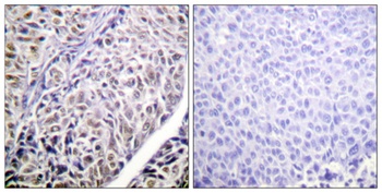 ARK-2 rabbit pAb Antibody