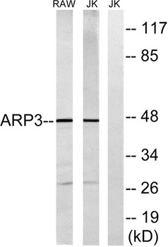 Arp3 rabbit pAb Antibody