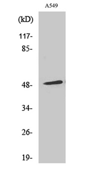 Arrestin-β-1 rabbit pAb Antibody