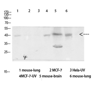 Arrestin-β-1 rabbit pAb Antibody