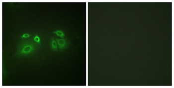 Arrestin-β-1 rabbit pAb Antibody