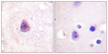 Arrestin-β-1 rabbit pAb Antibody