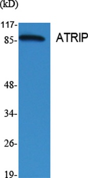 ATRIP rabbit pAb Antibody