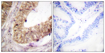 ATRIP rabbit pAb Antibody