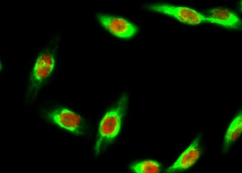 Bak rabbit pAb Antibody