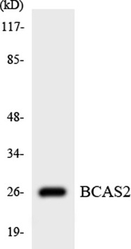 BCAS2 rabbit pAb Antibody