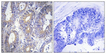 Bcl-w rabbit pAb Antibody