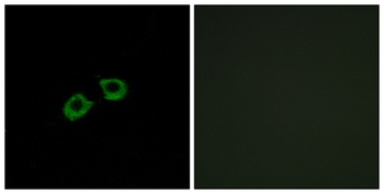 BIG2 rabbit pAb Antibody