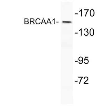 BRCAA1 rabbit pAb Antibody