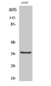 BST-1 rabbit pAb Antibody