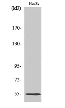 C1INH rabbit pAb Antibody