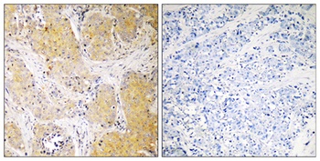 C1INH rabbit pAb Antibody