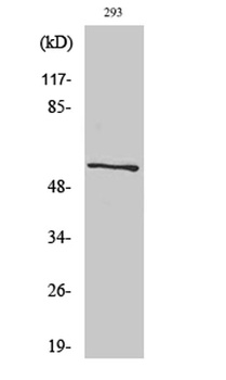CA IX rabbit pAb Antibody