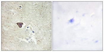 Cadherin-9 rabbit pAb Antibody