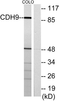 Cadherin-9 rabbit pAb Antibody
