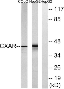 CAR rabbit pAb Antibody