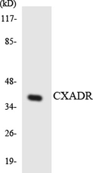 CAR rabbit pAb Antibody
