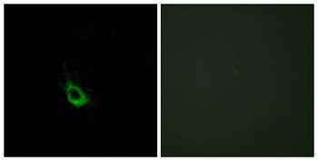 CARD 10 rabbit pAb Antibody