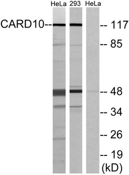 CARD 10 rabbit pAb Antibody