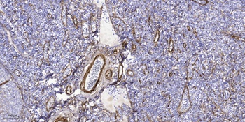 CARD 10 rabbit pAb Antibody