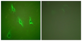 Caspase-10 B/D rabbit pAb Antibody