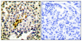 Caspase-6 rabbit pAb Antibody