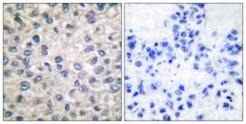 Catenin-α E/N rabbit pAb Antibody