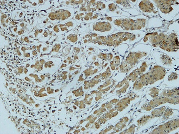Cathepsin B rabbit pAb Antibody