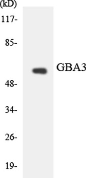 CBG rabbit pAb Antibody