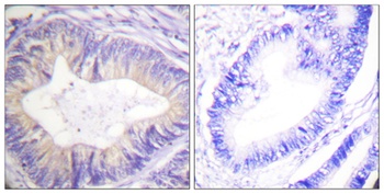 Cbl rabbit pAb Antibody