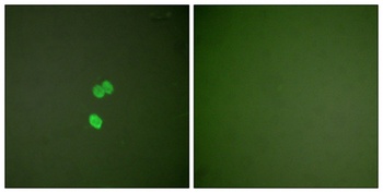 CBP 35 rabbit pAb Antibody