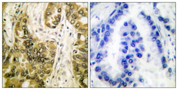 CBP 35 rabbit pAb Antibody