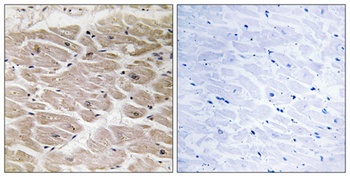 CCP2 rabbit pAb Antibody