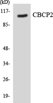 CCP2 rabbit pAb Antibody