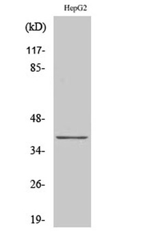 CCRL1 rabbit pAb Antibody