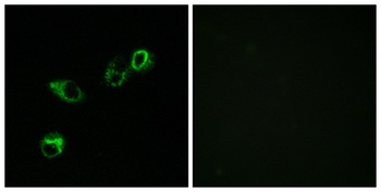 CCRL1 rabbit pAb Antibody