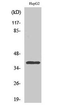 CCRL2 rabbit pAb Antibody