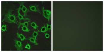 CCRL2 rabbit pAb Antibody