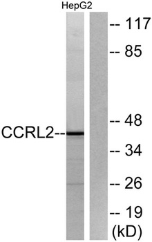 CCRL2 rabbit pAb Antibody