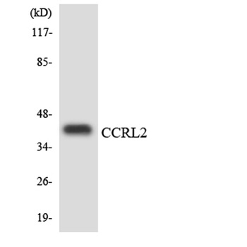 CCRL2 rabbit pAb Antibody