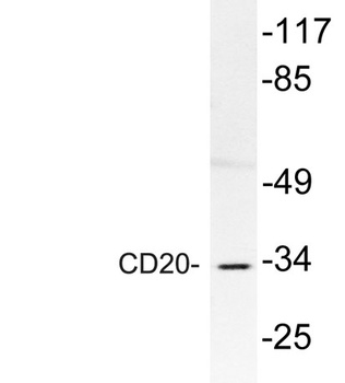 CD20 rabbit pAb Antibody