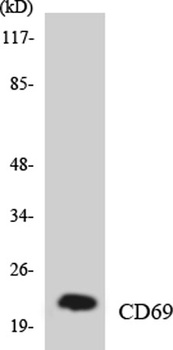 CD69 rabbit pAb Antibody