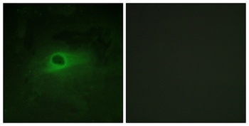 c-Fms rabbit pAb Antibody