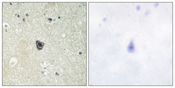 c-Fms rabbit pAb Antibody